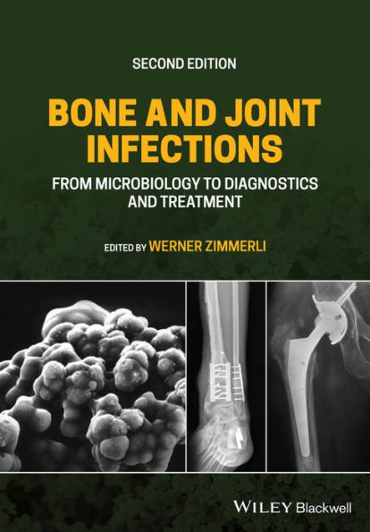 Bone and Joint Infections: From Microbiology to Diagnostics Treatment