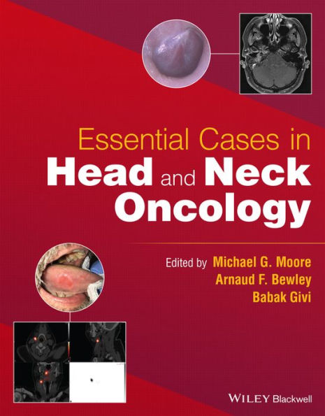 Essential Cases Head and Neck Oncology