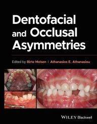 Title: Dentofacial and Occlusal Asymmetries, Author: Birte Melsen
