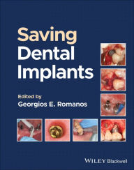 Title: Saving Dental Implants, Author: Georgios E. Romanos