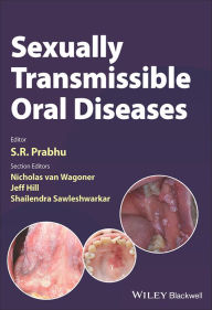 Title: Sexually Transmissible Oral Diseases, Author: S. R. Prabhu