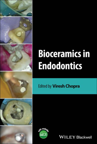 Bioceramics Endodontics