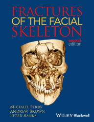 Title: Fractures of the Facial Skeleton / Edition 2, Author: Michael Perry