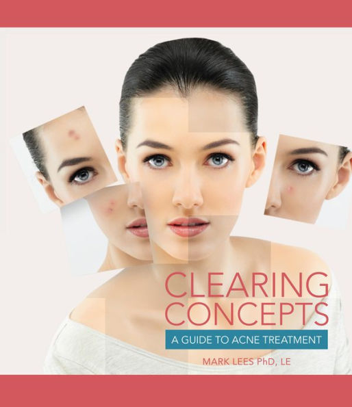 Clearing Concepts: A Guide to Acne Treatment / Edition 1