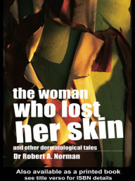 Title: The Woman Who Lost Her Skin: (And Other Dermatological Tales), Author: Rob Norman