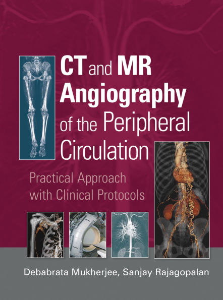 CT and MR Angiography of the Peripheral Circulation: Practical Approach with Clinical Protocols