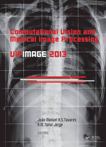 Computational Vision and Medical Image Processing IV: VIPIMAGE 2013 / Edition 1