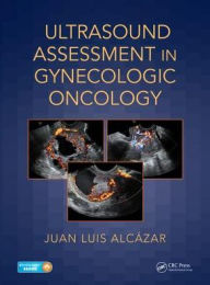 Title: Ultrasound Assessment in Gynecologic Oncology / Edition 1, Author: Juan Luis Alcázar