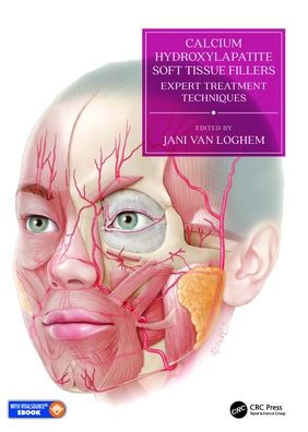 Calcium Hydroxylapatite Soft Tissue Fillers: Expert Treatment Techniques / Edition 1