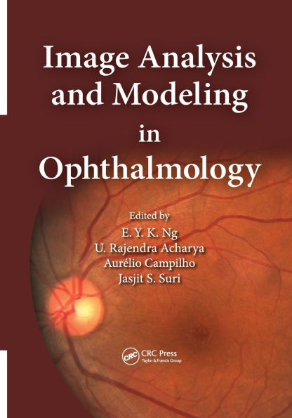 Image Analysis and Modeling in Ophthalmology / Edition 1