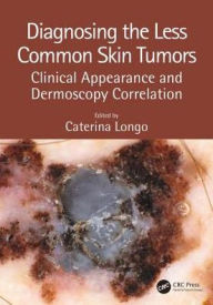 Title: Diagnosing the Less Common Skin Tumors: Clinical Appearance and Dermoscopy Correlation / Edition 1, Author: Caterina Longo