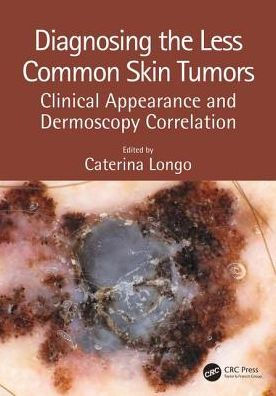 Diagnosing the Less Common Skin Tumors: Clinical Appearance and Dermoscopy Correlation / Edition 1