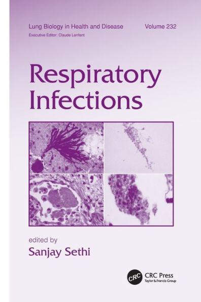 Respiratory Infections / Edition 1