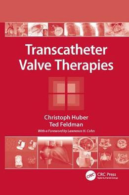 Transcatheter Valve Therapies / Edition 1