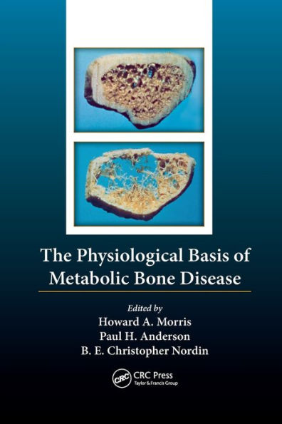 The Physiological Basis of Metabolic Bone Disease / Edition 1