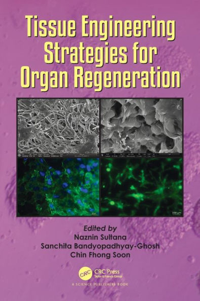 Tissue Engineering Strategies for Organ Regeneration / Edition 1