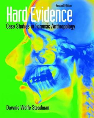 Hard Evidence: Case Studies Forensic Anthropology