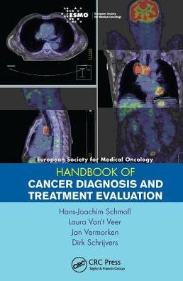 ESMO Handbook of Cancer Diagnosis and Treatment Evaluation / Edition 1