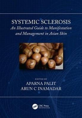 Systemic Sclerosis: An Illustrated Guide to Manifestation and Management in Asian Skin / Edition 1