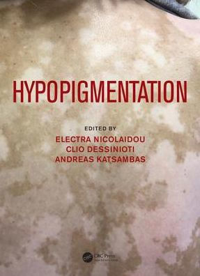 Hypopigmentation / Edition 1