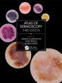 Atlas of Dermoscopy: Third Edition