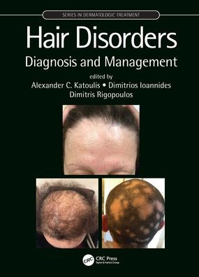 Hair Disorders: Diagnosis and Management