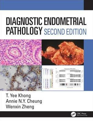 Diagnostic Endometrial Pathology 2E / Edition 2