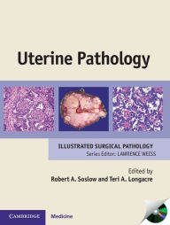 Title: Uterine Pathology, Author: Robert A. Soslow MD