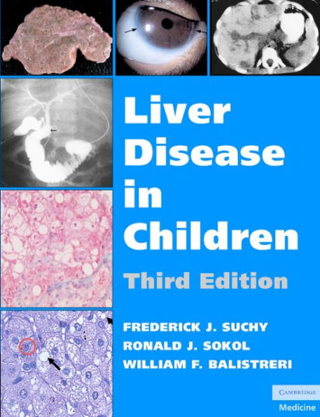 Liver Disease in Children