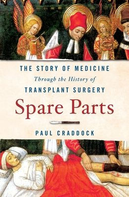 Spare Parts: the Story of Medicine Through History Transplant Surgery