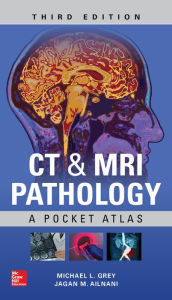 Title: CT & MRI Pathology: A Pocket Atlas, Third Edition, Author: Michael L. Grey