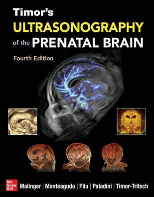 Timor's Ultrasonography of the Prenatal Brain, Fourth Edition / Edition 4