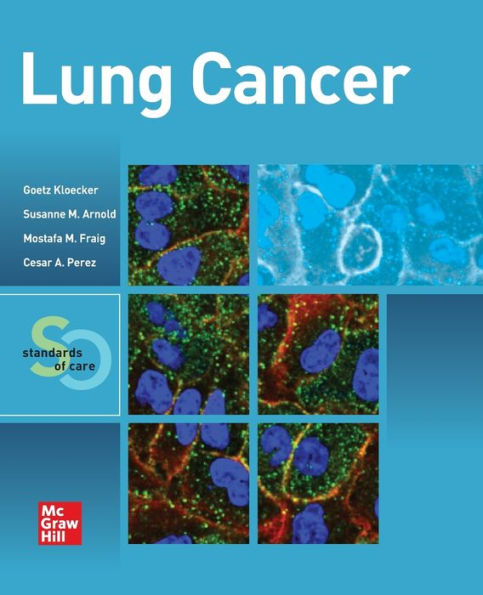 Lung Cancer: Standards of Care