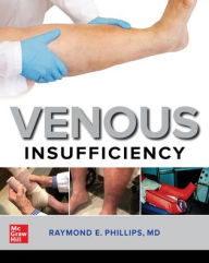Title: Venous Insufficiency, Author: Raymond E. Phillips