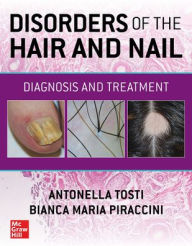 Download a book to your computer Disorders of the Hair and Nail: Diagnosis and Treatment 9781260462470 by Antonella Tosti, Bianca Maria Piraccini DJVU