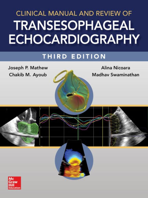 Clinical Manual and Review of Transesophageal Echocardiography, 3/e by ...