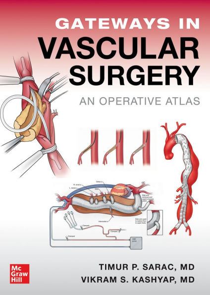 Gateways Vascular Surgery: An Operative Atlas