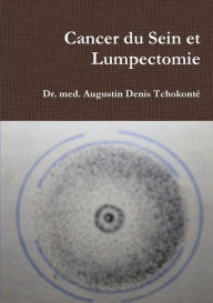 Title: Cancer Du Sein Et Lumpectomie, Author: Dr Med Augustin Denis Tchokonte