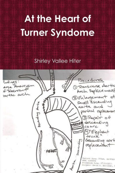 At The Heart of Turner Syndrome