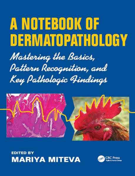 A Notebook of Dermatopathology: Mastering the Basics, Pattern Recognition, and Key Pathologic Findings