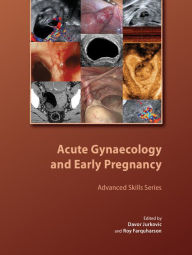 Title: Acute Gynaecology and Early Pregnancy, Author: Davor Jurkovic