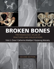 Title: Broken Bones: The Radiologic Atlas of Fractures and Dislocations, Author: Felix S. Chew