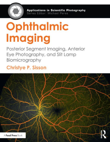 Ophthalmic Imaging: Posterior Segment Imaging, Anterior Eye Photography, and Slit Lamp Biomicrography