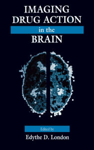 Title: Imaging Drug Action in the Brain, Author: Edythe D. London