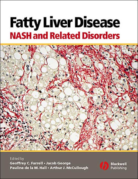 Fatty Liver Disease: NASH and Related Disorders / Edition 1