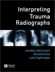 Title: Interpreting Trauma Radiographs / Edition 1, Author: Jonathan McConnell