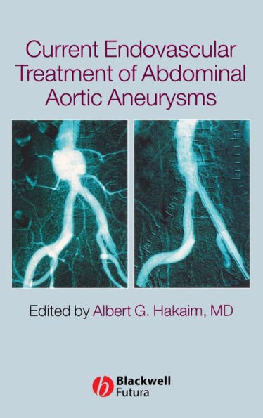 Current Endovascular Treatment of Abdominal Aortic Aneurysms / Edition 1