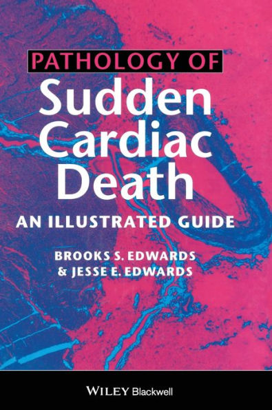 Pathology of Sudden Cardiac Death: An Illustrated Guide / Edition 1