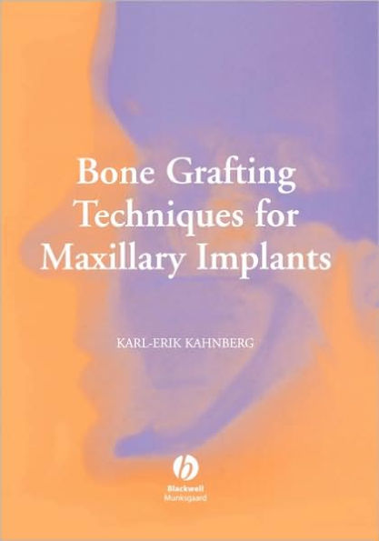 Bone Grafting Techniques for Maxillary Implants