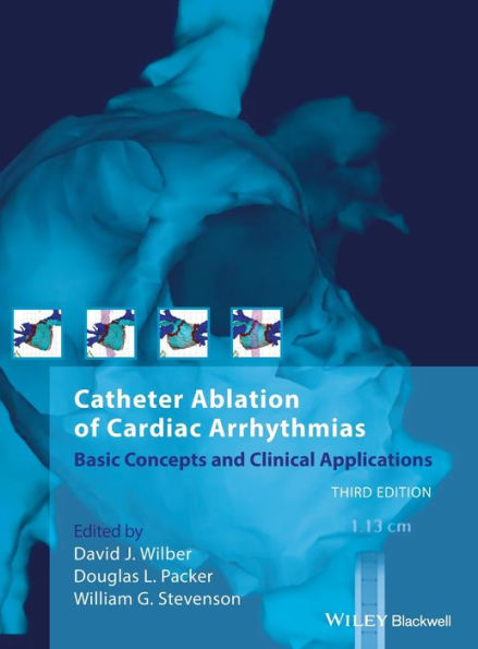 Catheter Ablation of Cardiac Arrhythmias: Basic Concepts and Clinical Applications